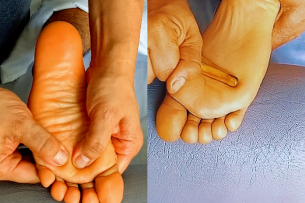 Trigger Point Therapy